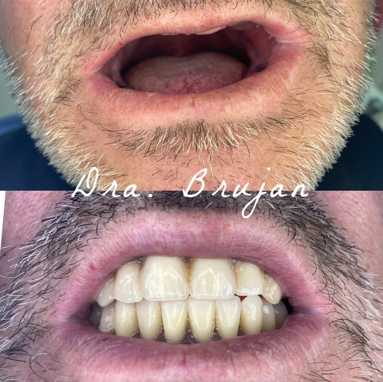 Equipo dental